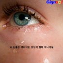 눈물은 약하다는 상징이 절대 아니거늘~막힌 눈물차단관 뚫기 이미지