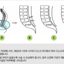 라임나무한의원 네이버블로그