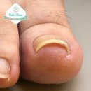 타임네일 페디베네 이미지