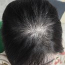 쏘닉 | 집에서 하는 청담 헤어스파 루틴 : 씨쏘닉 탈모 토닉 후기