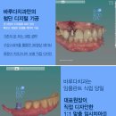 덴탈디자인 기공소 이미지