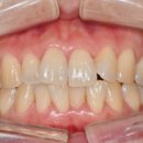 수원탑플란트치과의원 이미지