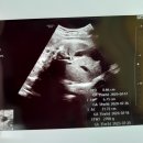 매곡사거리 온천골가마솥국밥 앞 횡단보도 | 현풍국밥맛집/온천골한우가마솥국밥/국물맛이 끝내줘요~