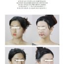 고운라인피부관리실