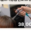 탑스칼프