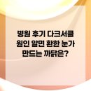 건강한 생활에 꼭 알아야할 의약상식 | 병원 후기 다크서클 원인 알면 환한 눈가 만드는 까닭은?