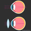 안경백서 이미지