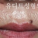유디트의원 네이버블로그