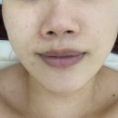 [듀얼소닉 맥시멈] 피부 홈 케어 고주파 마사지기 듀얼소닉 맥시멈 사용방법 및 후기