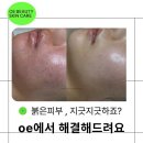 광채 피부샵