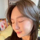 큐티멍 | 신사역피부과 이마필러 큐티필 2cc 후기, 붓기, 멍, 비용