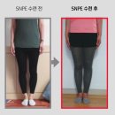 대치경희한의원 | [SNPE] SNPE 바른자세척추운동 : 거북목 허리디스크 척추측만 골반교정 운동
