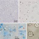 징거미새우과 줄새우속 밀새우(Palaemon carinicauda)의 미포자충 Paospora carinifang 이미지