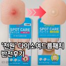 붉은천 | “천원 맞아?” 다이소 여드름패치, 써보니 반전이었어요
