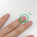 위례네일 네일어베인 문제성손톱 찢어진손톱 관리 후기
