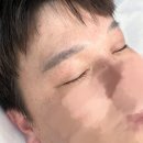 중원하대원-D-5 | 성남남자눈썹문신탈각후} 후기 탈각후도 자연스럽게 ~