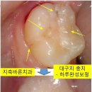 바른치과기공소 이미지