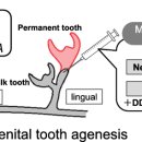 Anti-USAG-1 therapy for tooth regeneration through enhanced BMP signaling 이미지