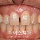 디어스 두번째이야기 이미지