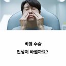 비염 수술 후기 총정리｜솔직한 리뷰 모음으로 현실 체크!