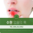 엘포트봄봄이비인후과의원 네이버블로그