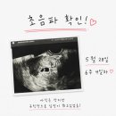 김현진산부인과의원 네이버블로그
