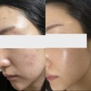 위드율 에스테틱 | 여드름고민은 광주 화정동 피부복구 전문관리샵 "위드율에스테틱"에서!