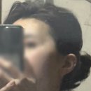 유앤박미래피부과의원 | (내돈내산)대구 닥터스피부과 덴서티 클래식 600샷 후기