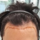 모디헤어플란트의원 이미지