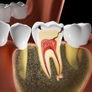 탑연세치과병원 이미지