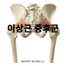 이상근 증후군 엉덩이 통증 위너휘트니스