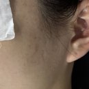 수원 망포동피부관리 가은에스테틱 미백