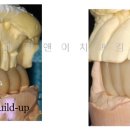 샤인치과기공소 이미지