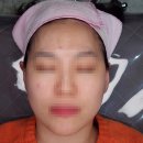 세븐일레븐 의정부회룡점 | [의정부 피부관리] 회룡역 피부관리 리셋뷰티 디바이스 톤업 관리 후기