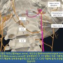 어지럼증, 이석증, 균형감 상실, 현기증의 숨은 원인은 두개경추불안정 이미지