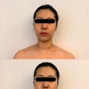 로니로티앤이태리반점 | 서온에스테틱 온결 윤곽 테라피 1/10회차 후기 - 광주웨딩관리 추천, 꼼꼼하고 시원한 개인 맞춤형 관리