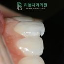 연수센트럴치과의원 네이버블로그
