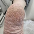 네일글림