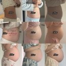 [Thanks Diary] 초산모 제왕절개 출산 1일차 후기 - 봄빛병원 (윤땡스 지구별 도착!)