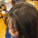 퀀텀SMP두미각 | [서울 강서구/마곡동] 밀도보강SMP 정수리 가르마 커버 무통 SMP 맛집 '퀀텀 SMP' 찐 후기 !