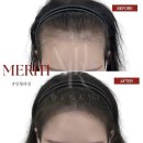 헤어라인 이미지