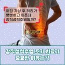 성모류마내과의원 | 강직성 척추염 진료과 찾는다면 류마티스내과인 류마내과 확인