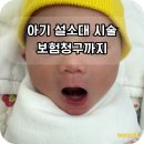 동부화재(주) | 아기 설소대 시술 후기｜혀유착증 보험청구·재시술까지