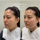 빅스페이스 이미지