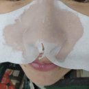 피지고민에는 메디필 [엑스트라슈퍼9] 일소 [딥 클린 마스터]
