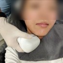 디자인키 | 수원 올타이트리프팅 1:1맞춤디자인 키닥터 피부과 다녀온 솔직후기