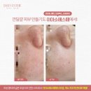 이아소에스떼