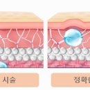 테라스의원 네이버블로그