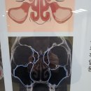 삼흥약국 | 서울-삼성드림이비인후과 삼성점