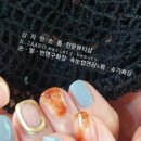 강자안손톱